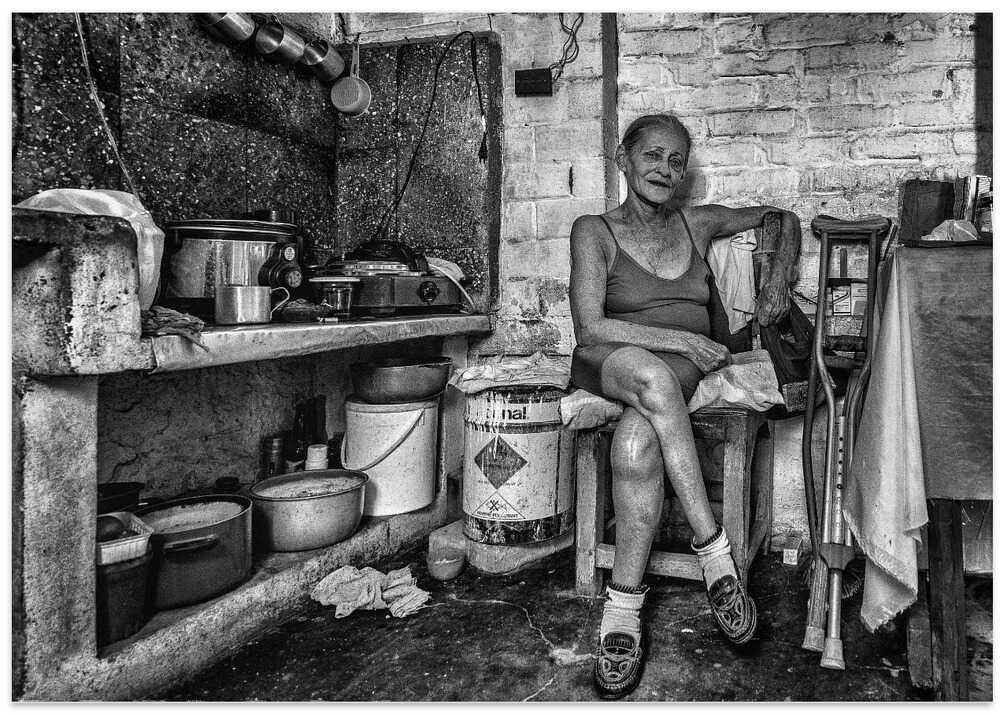 Maria, polio victim / Central Cuba